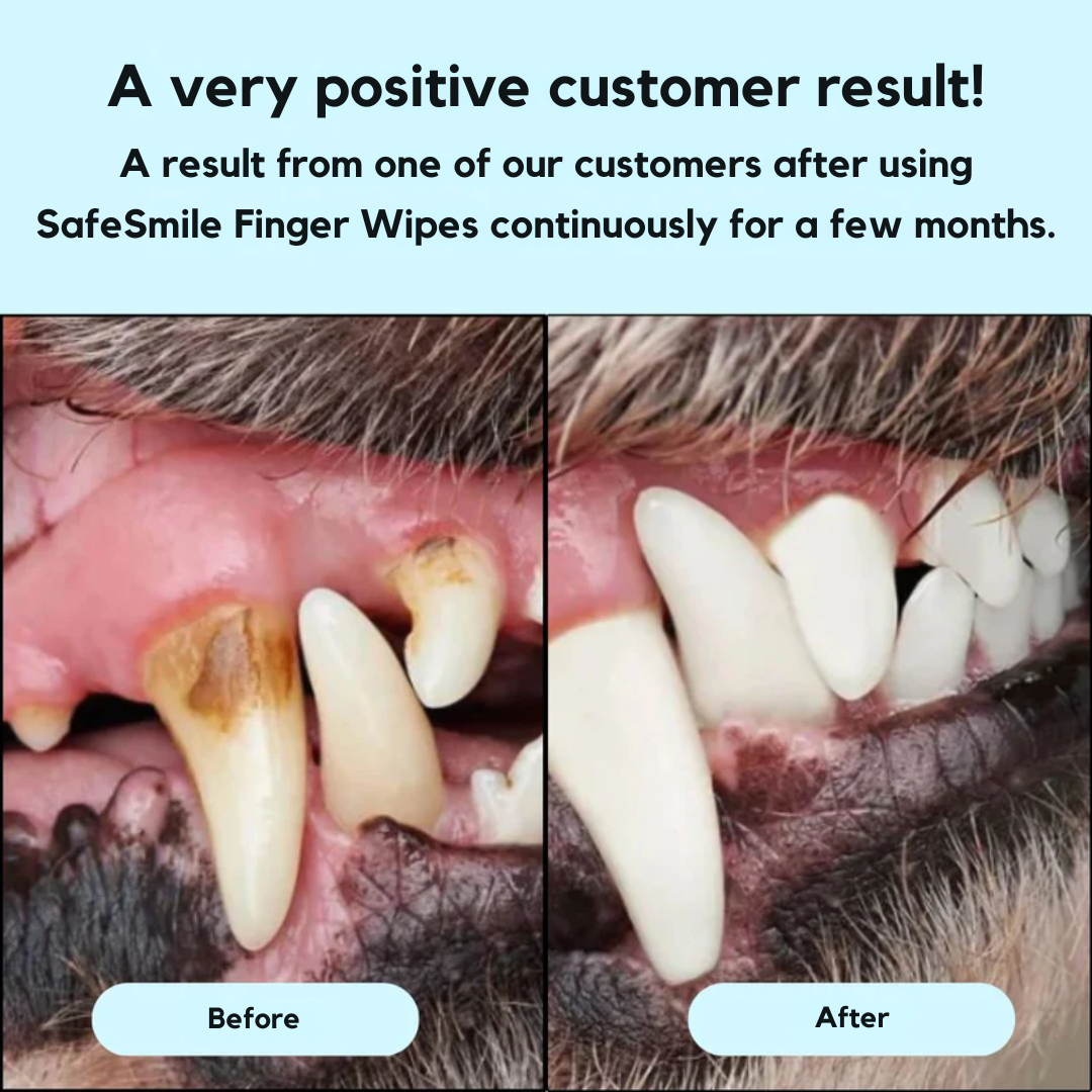 SafeSmile Finger Wipes